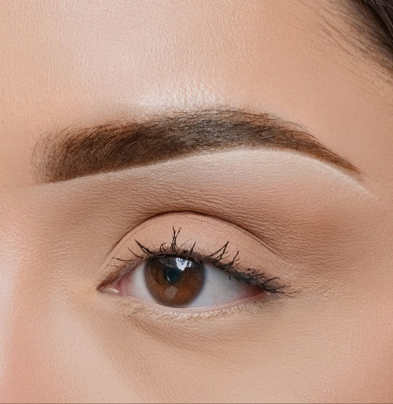 After image showing the eyebrow area following a cosmetic procedure, close-up view
