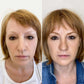 Brovi Freckle – professional permanent makeup & beauty product