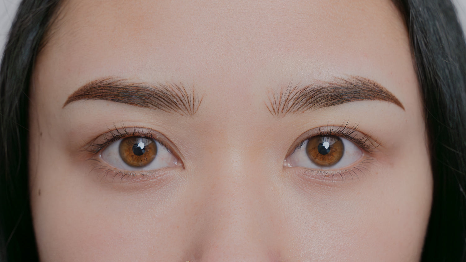After image showing the eyebrow area following a cosmetic procedure