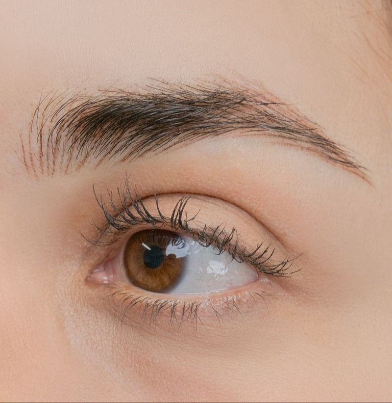 After image showing the eyebrow area following a cosmetic procedure, close-up view
