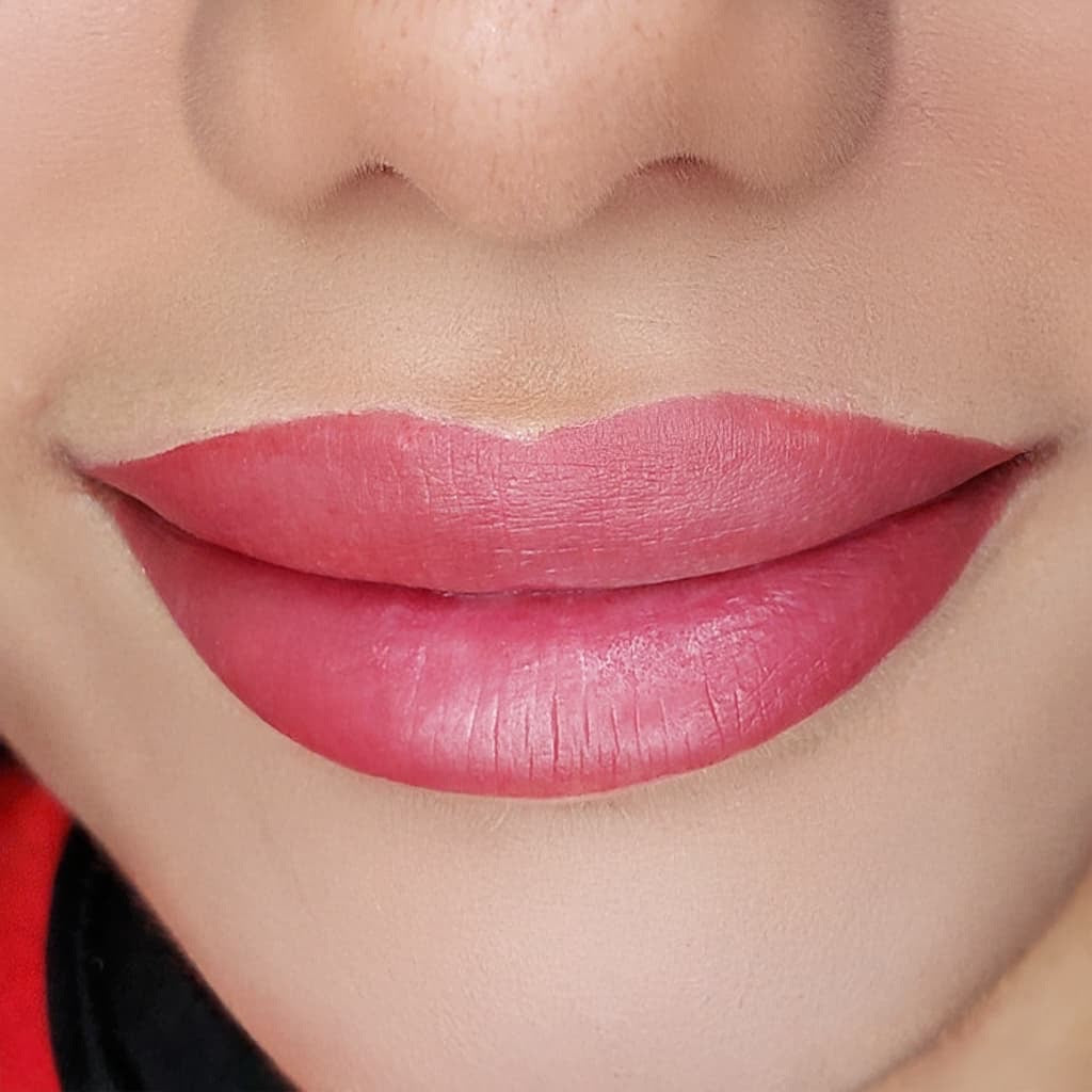After image showing the lip area following a cosmetic procedure, close-up view
