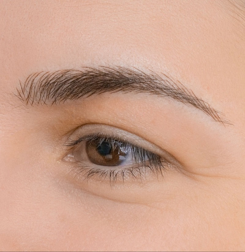 After image showing the eyebrow area following a cosmetic procedure, close-up view
