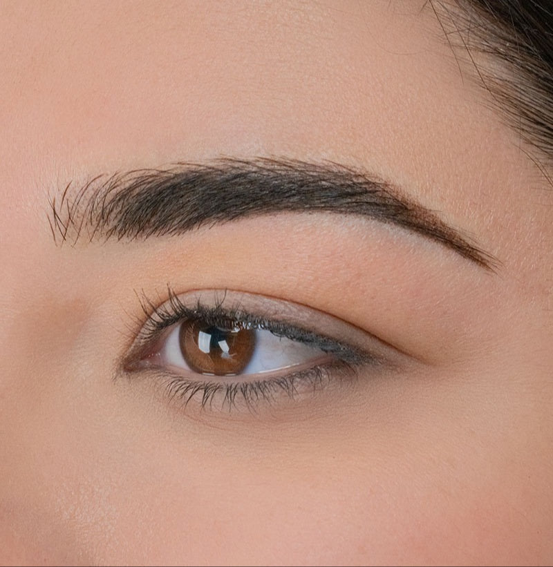 After image showing the eyebrow area following a cosmetic procedure, close-up view
