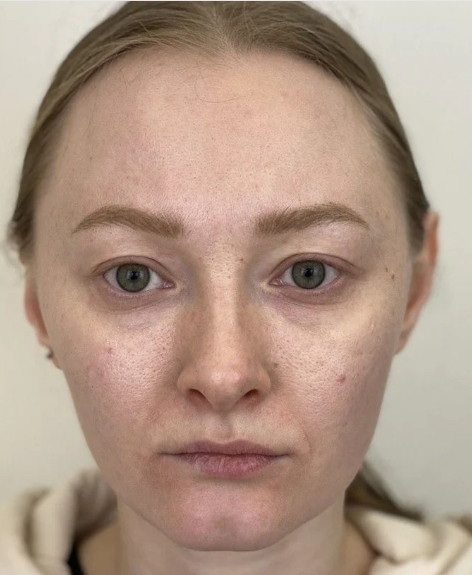 Brovi+ Freckle