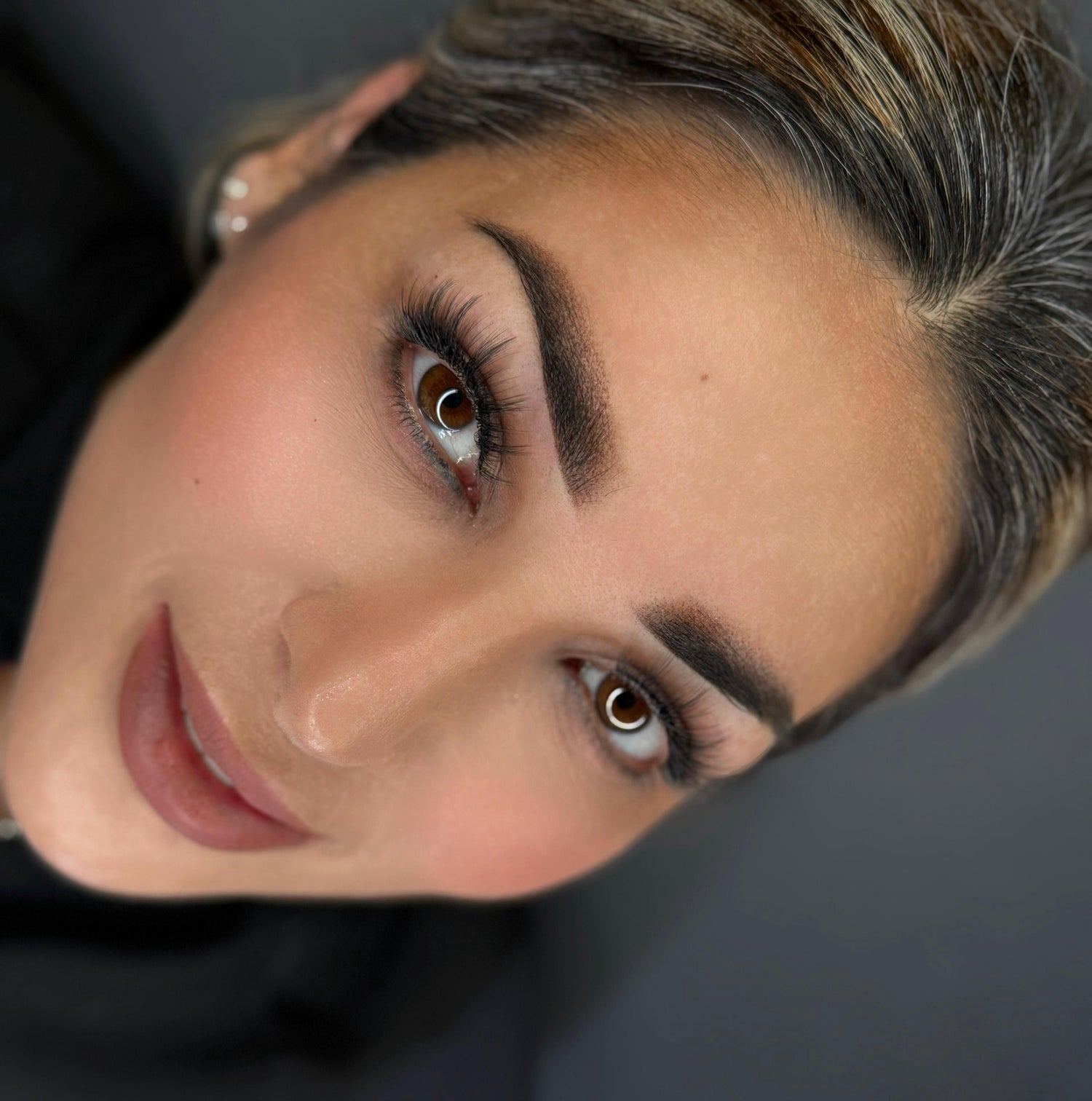 After image showing the treatment area following a cosmetic procedure
