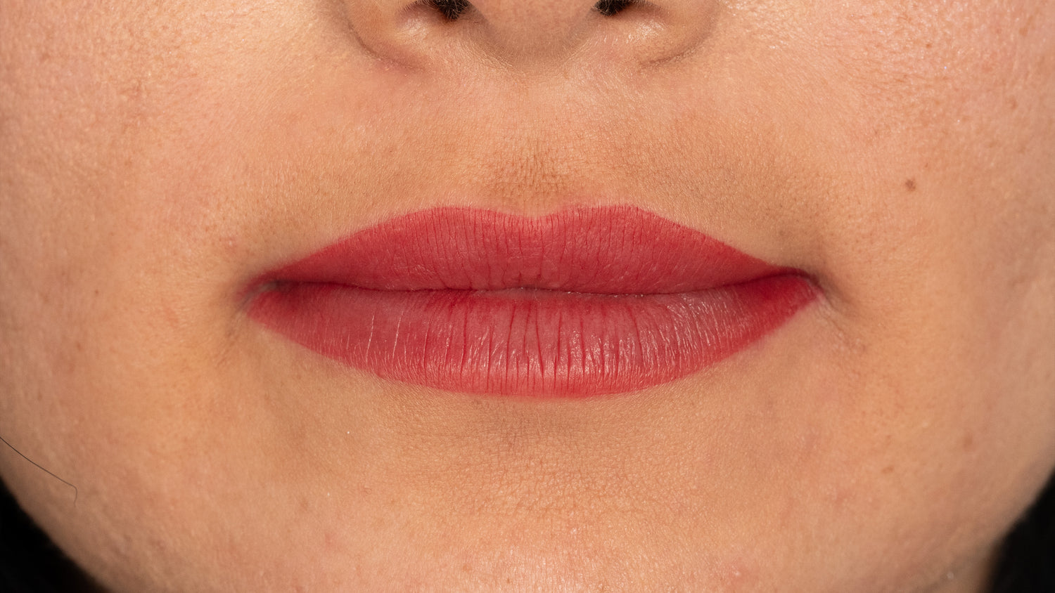 After image showing the lip area following a cosmetic pigmentation procedure

