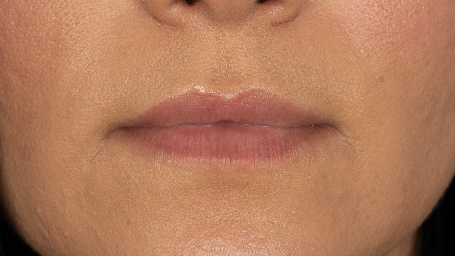 Before image showing the lip area prior to a cosmetic pigmentation procedure